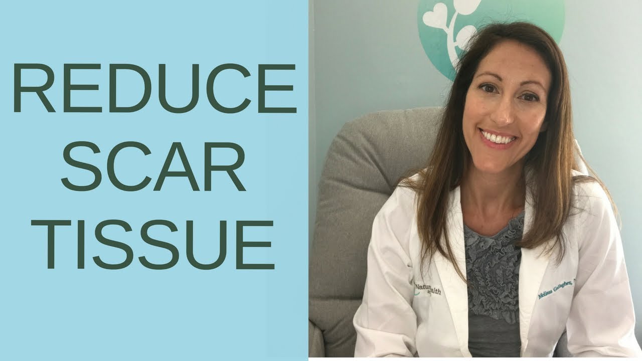 How to Get Rid of Scar Tissue, Keloids, Adhesions & Pesky Scars | Natural Scar Reduction Treatment