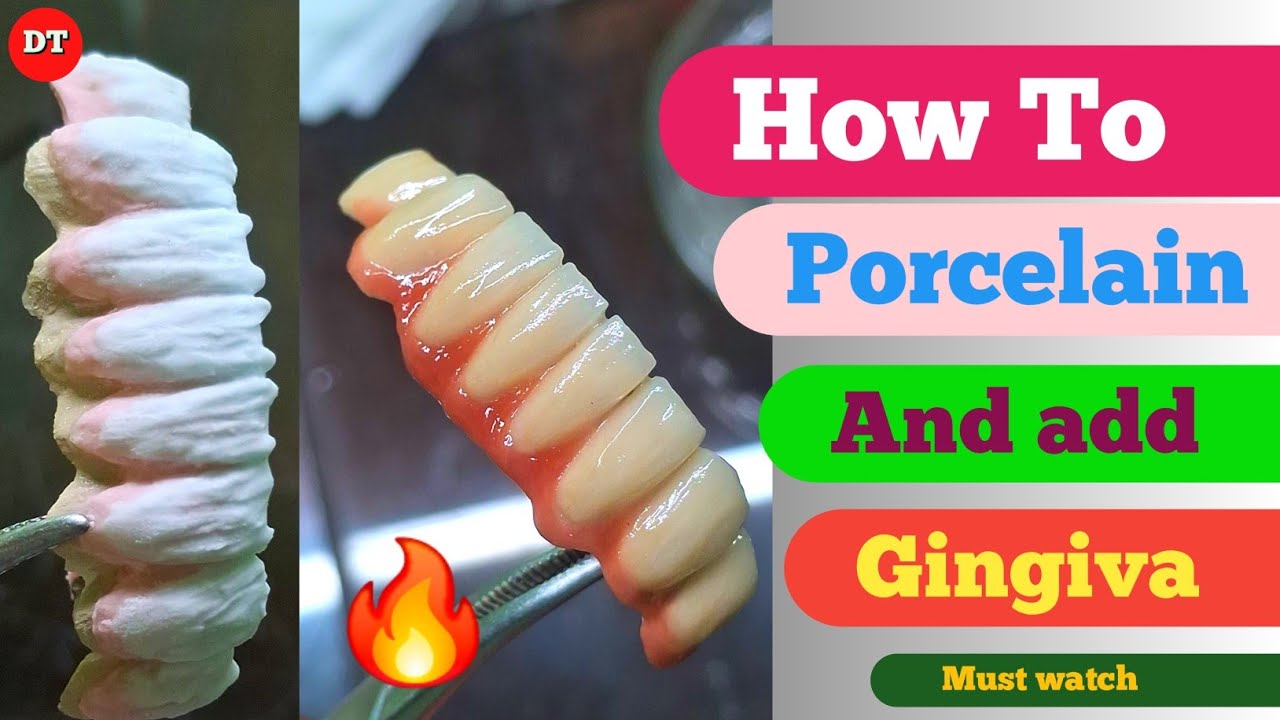 How To Porcelain And add gingiva Full Video| Ceramic Layering Techniques| ceramic with gingiva video