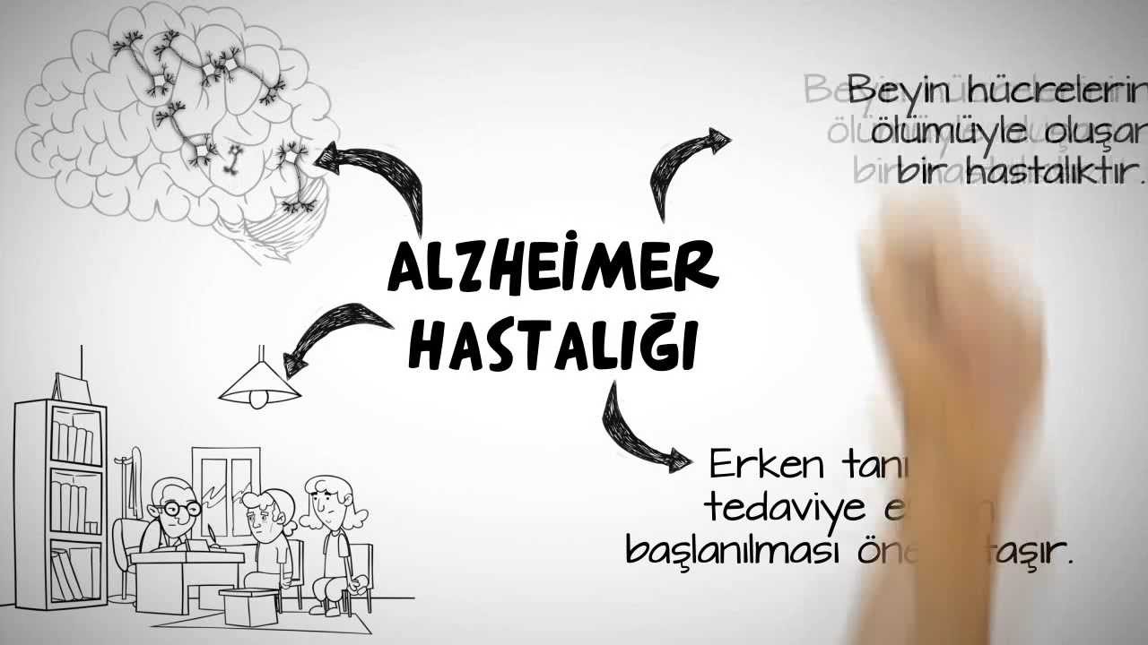 Alzheimer Hastalığı