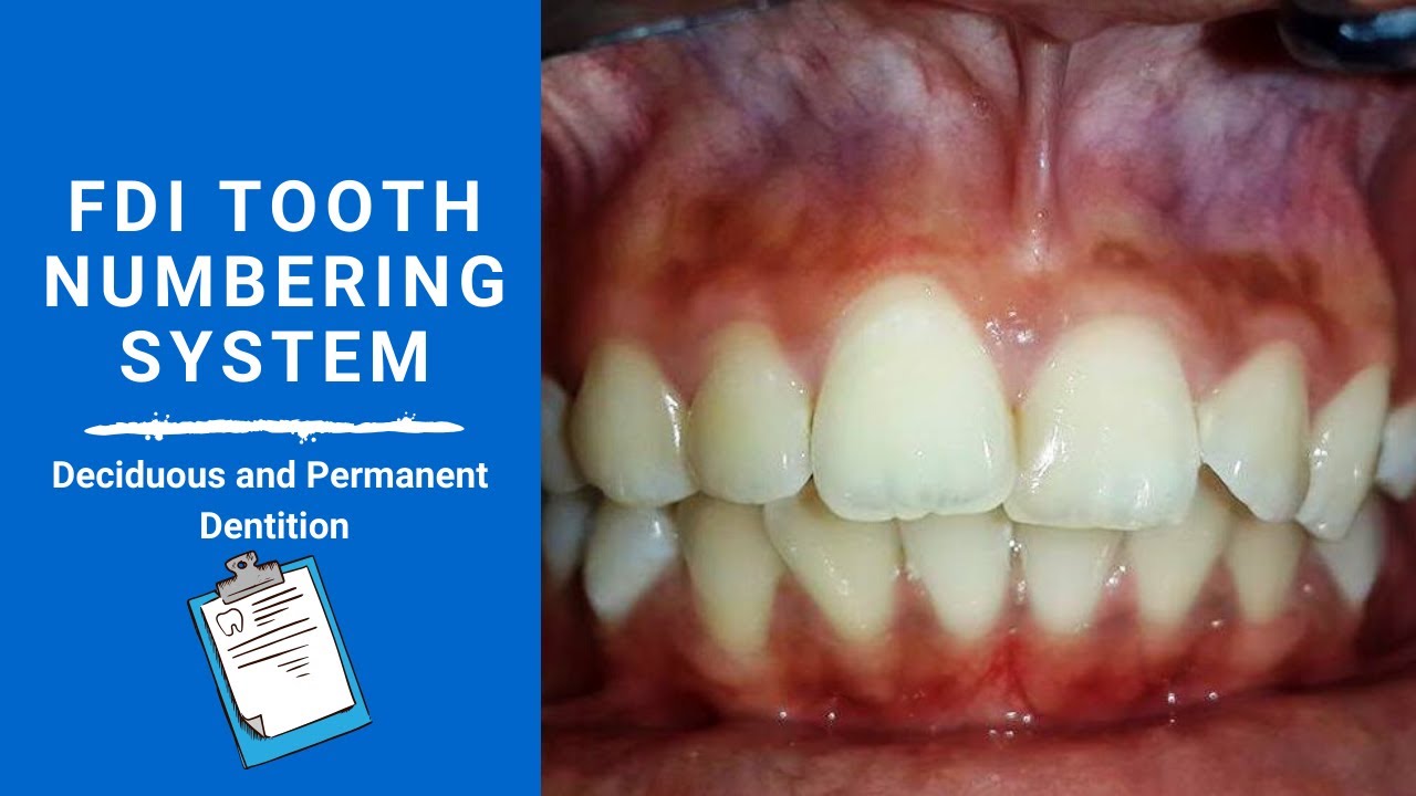 FDI Tooth Notation System | Tooth numbering system
