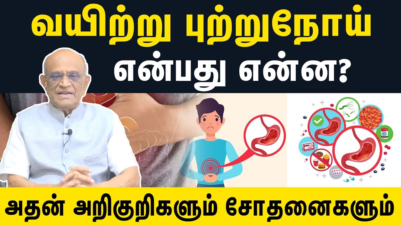 வயிற்று புற்றுநோய் என்பது என்ன? அதன் அறிகுறிகளும் சோதனைகளும் | Samayam Tamil Lifestyle