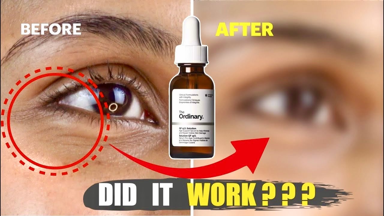 The Ordinary AGE-SUPPORT Gf15%: лучшая сыворотка против старения?