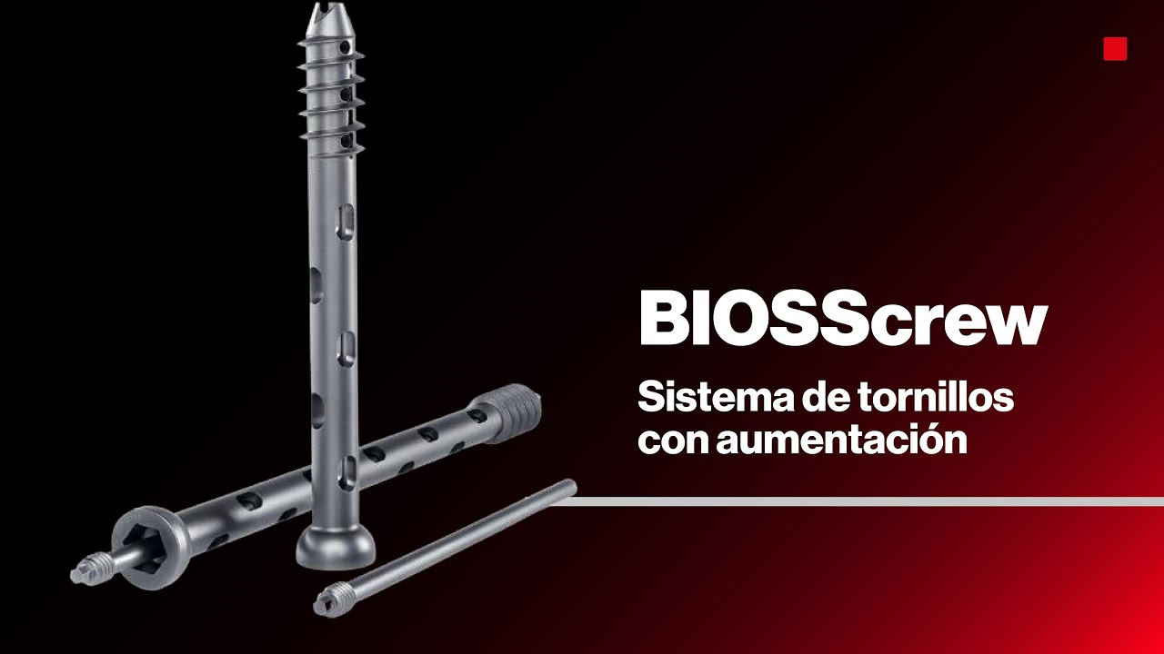 BIOSScrew | Sistema de tornillos con aumentación
