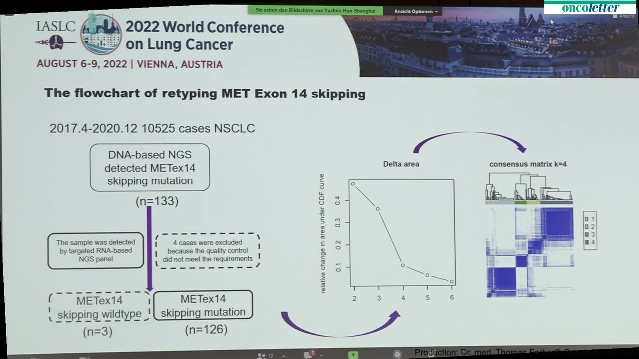 Intertumoral molecular heterogeneity of non-small cell lung cancer with MET Exon 14 Skipping &ndash; D...