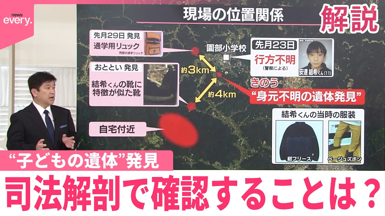【解説】&ldquo;子どもの遺体&rdquo;司法解剖でまず確認することは？