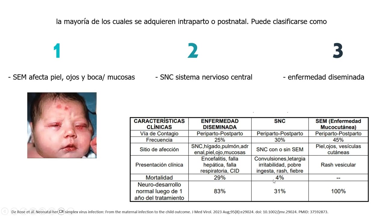 9 Herpes en el embarazo