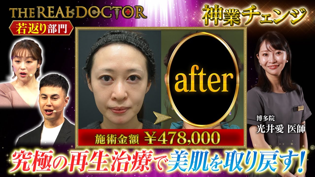 【切らない若返り】30代の疲れ顔を再生治療で肌にハリと透明感をもたらす博多の神業ドクター 