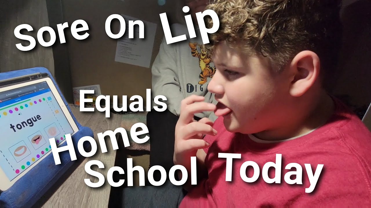 Sore On Lip Equals Home School Today