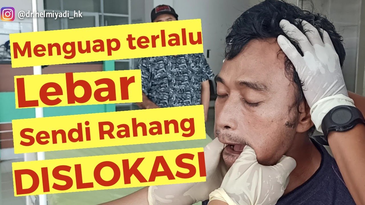Akibat menguap terlalu lebar dan ketawa ngakak, sendi rahang dislokasi