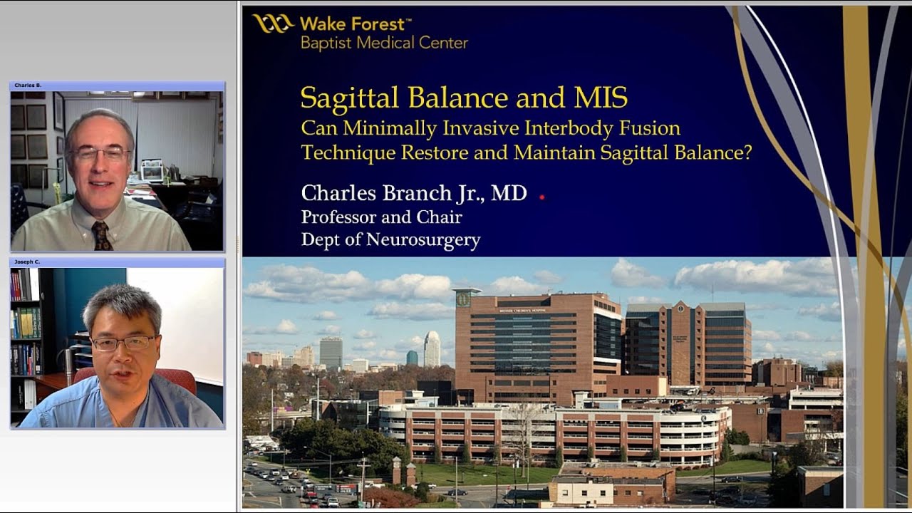 A Hybrid Minimally Invasive Posterior Interbody Fusion Technique (Preview)