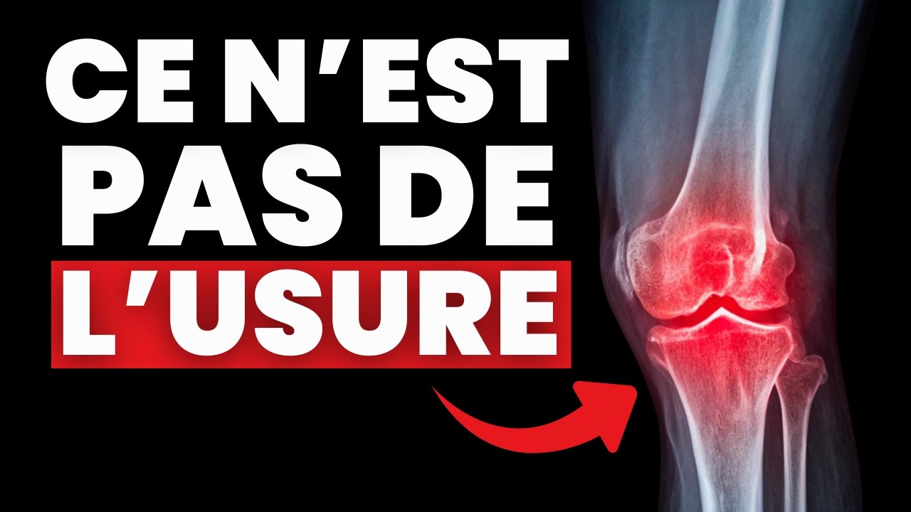Comment (vraiment) aider un patient arthrosique, étape par étape.