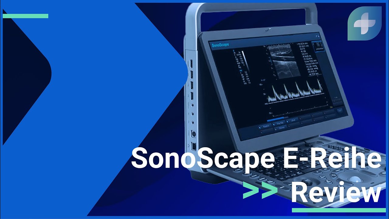 SonoScape E3 in der Review | E-Reihe mit E1, E2, E3 | Was können Laptop Ultraschallgeräte leisten?