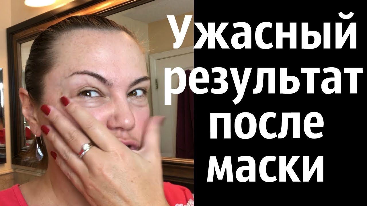 УЖАСНЫЙ РЕЗУЛЬТАТ - МАСКА L'oreal - / Обзор умывалки и тонера L'oreal / Моё мнение