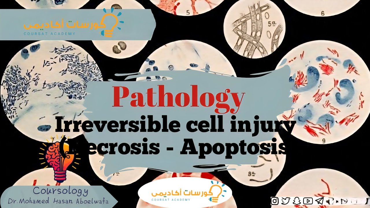 Irreversible cell injury (necrosis - apoptosis)