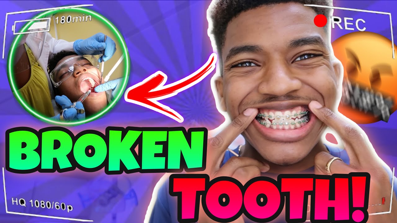 I BROKE MY TOOTH!