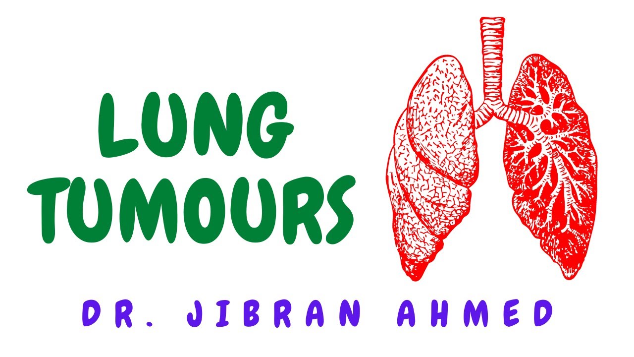 LUNG TUMOURS II SYSTEMIC PATHOLOGY II ROBBINS 10TH E II PATHOLOGY LECTURES II @DrJIBRANAHMED