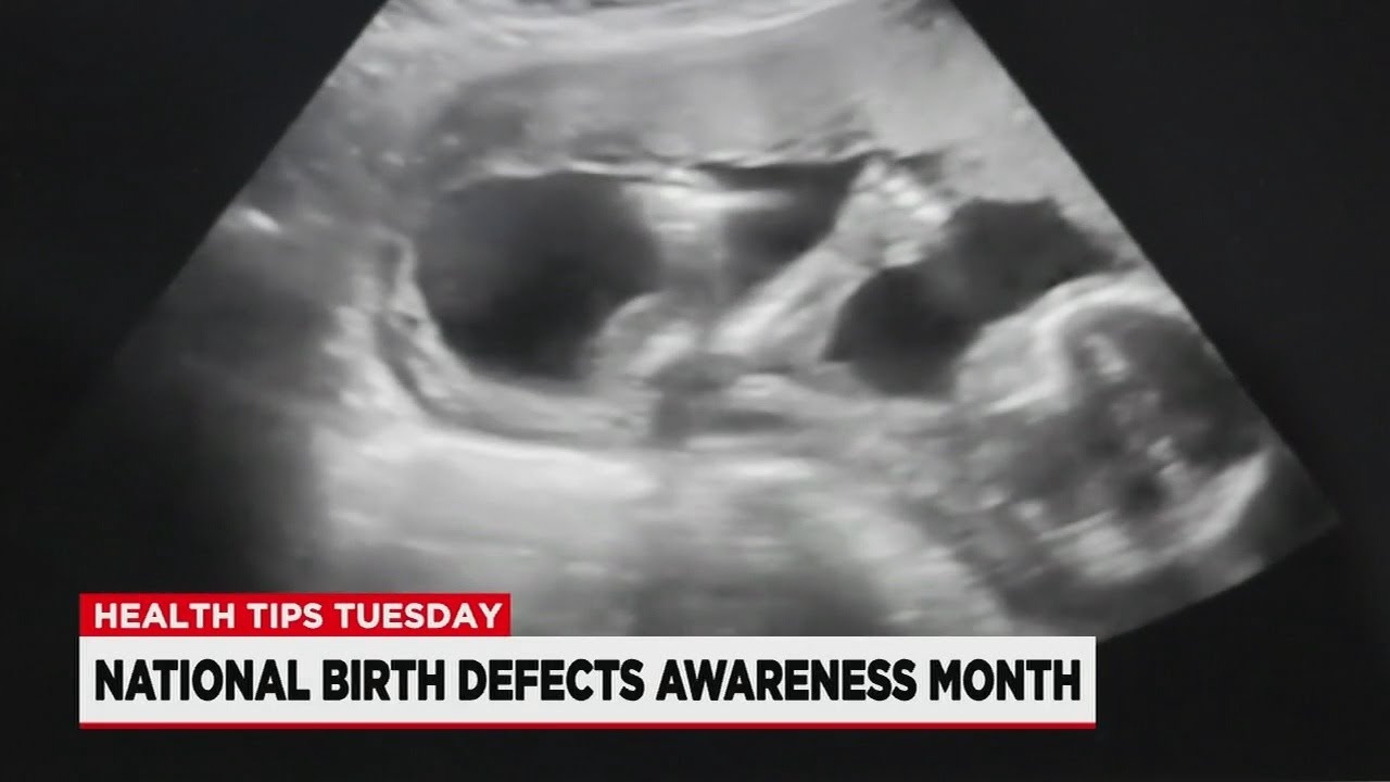 Health Tips Tuesday: Birth Defect Awareness Month