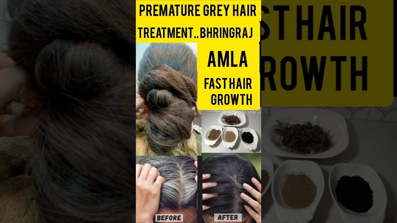 #prematuregreying