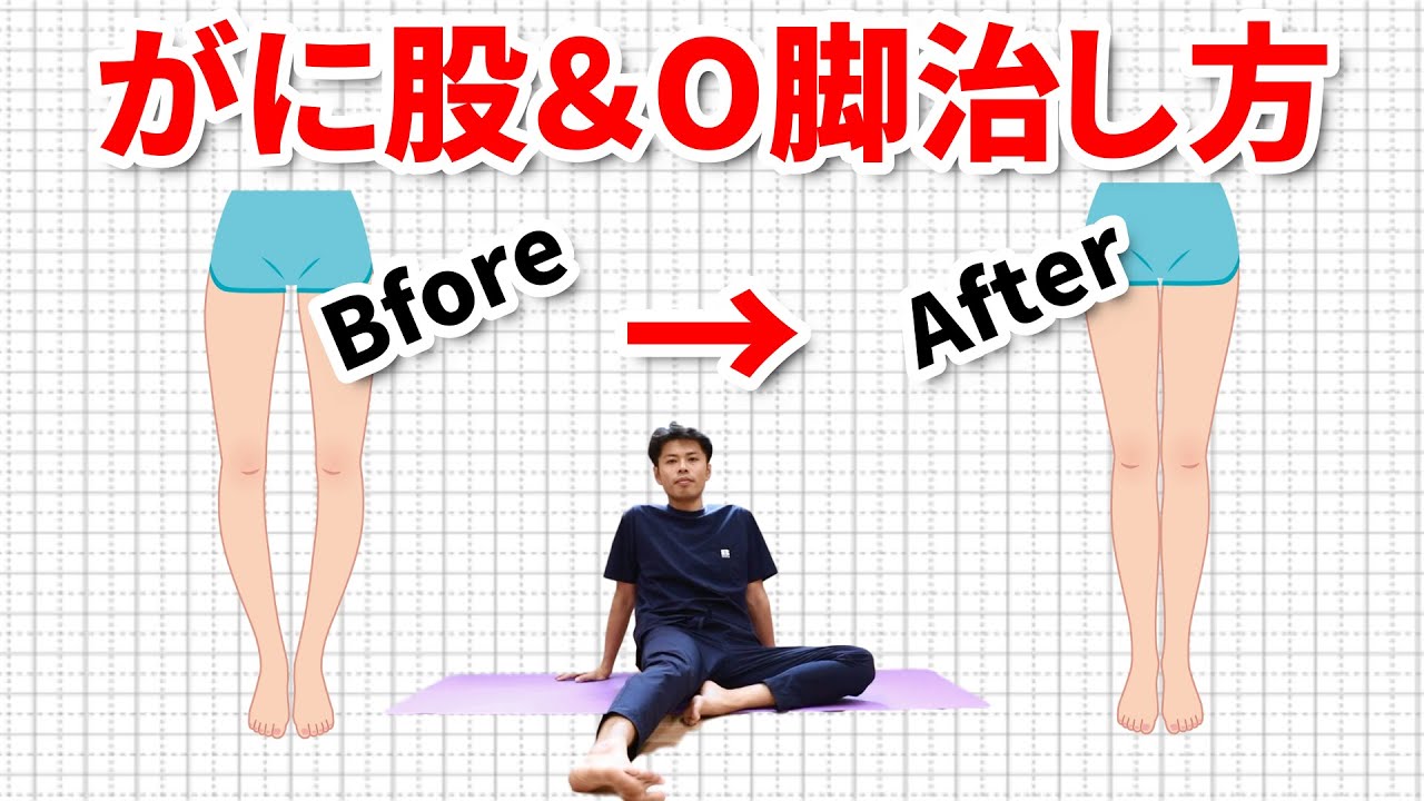 【10分】がに股＆O脚を簡単に治す矯正方法｜東京整体サロン