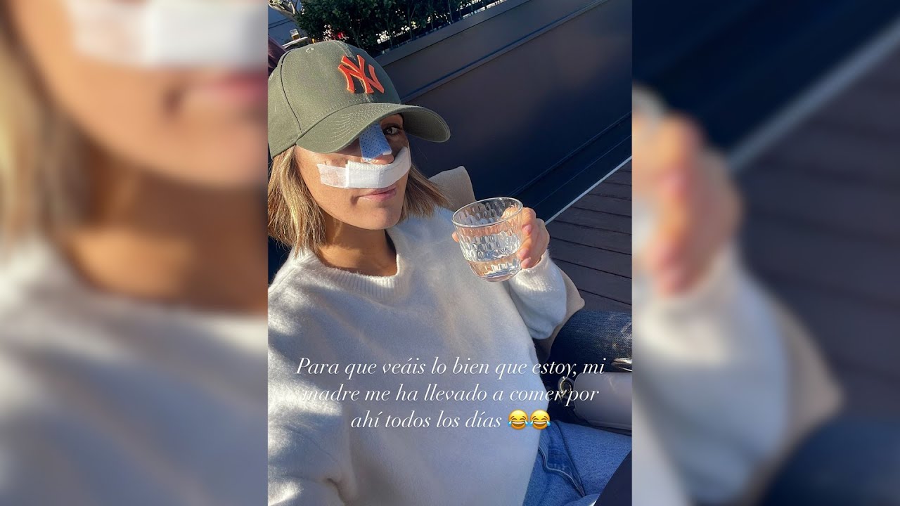 Anna Padilla anuncia que se ha sometido a una rinoplastia