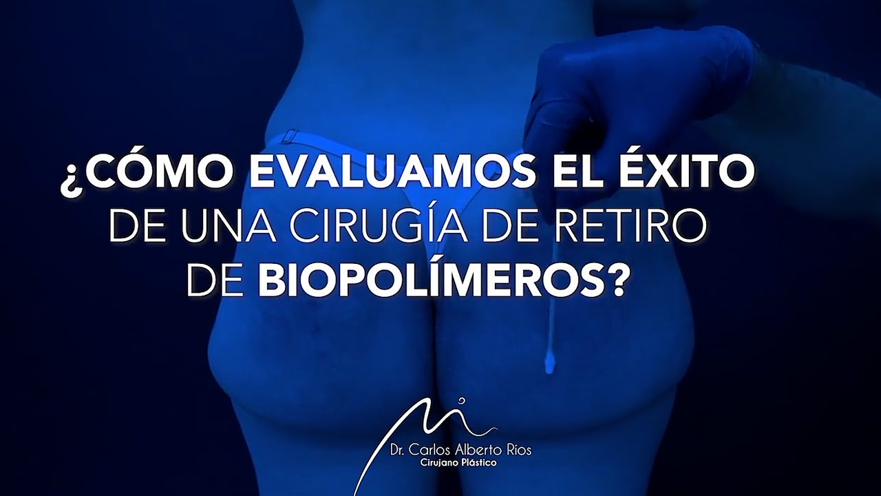 ¿Cómo saber si la cirugía de retiro de biopolímeros realmente fue exitosa?