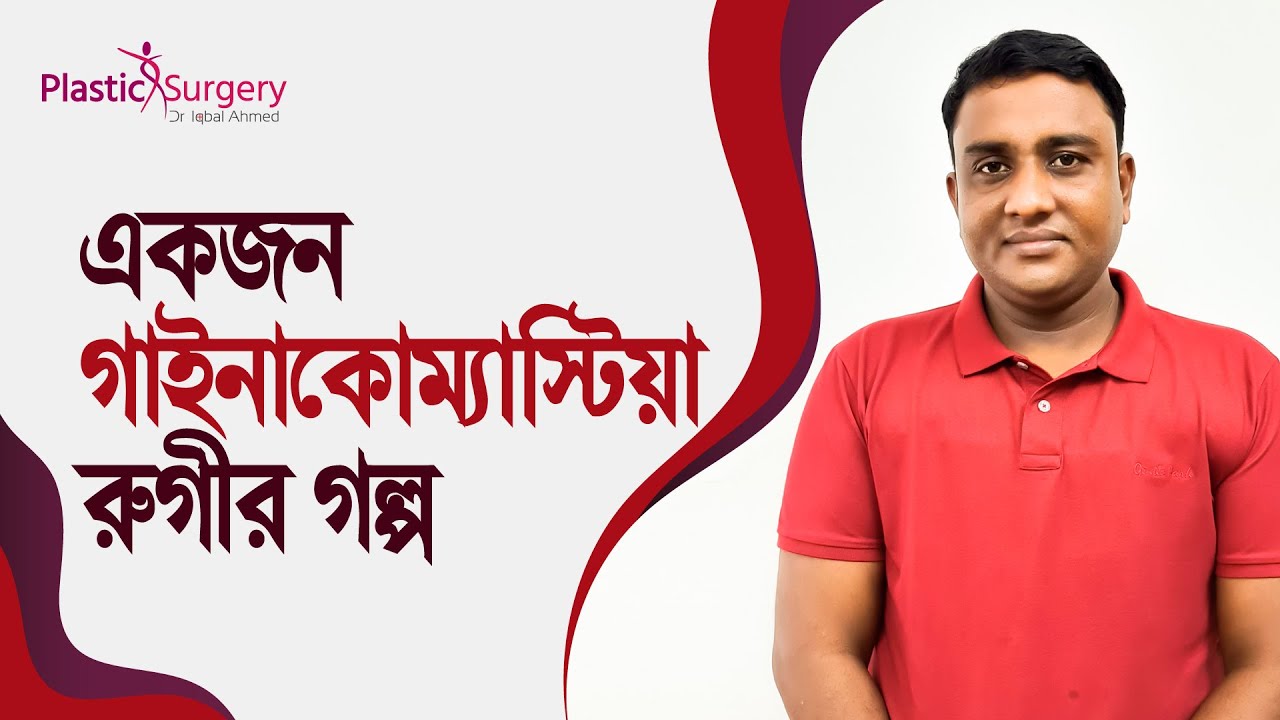 গাইনাকোম্যাস্টিয়া সার্জারির পর রুগীর অভিজ্ঞতা | Gynecomastia Patient's Experience after surgery