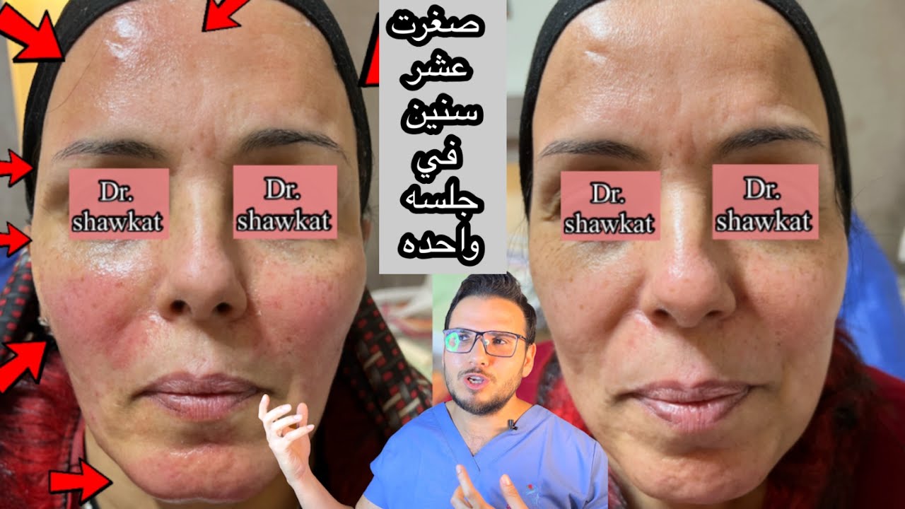 ازاي صغرت عشر سنين في جلسه واحده ؟ ازاي منعجزش؟