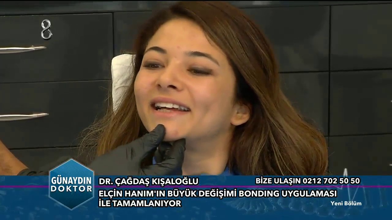 Bonding ile Büyük Değişim