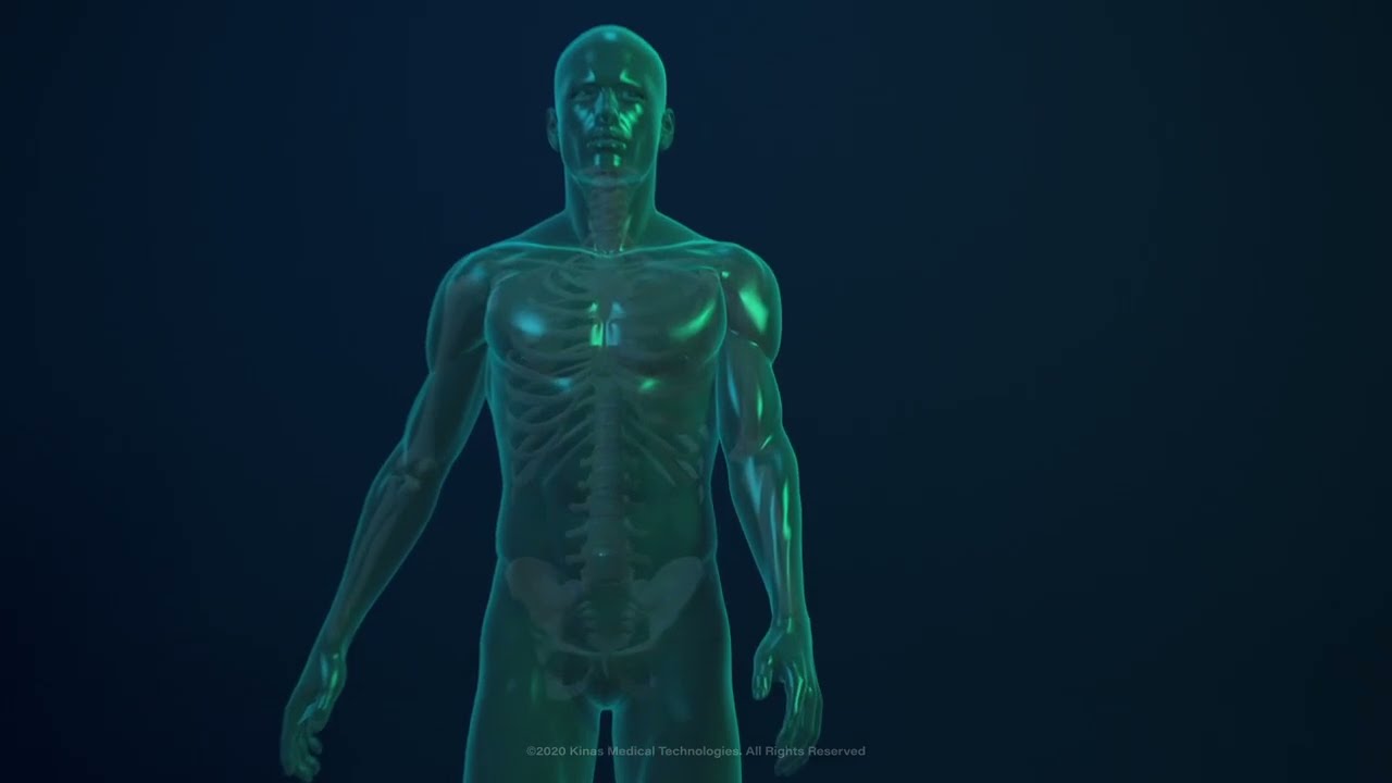MiracleWave  The Science Behind Shock Wave Therapy