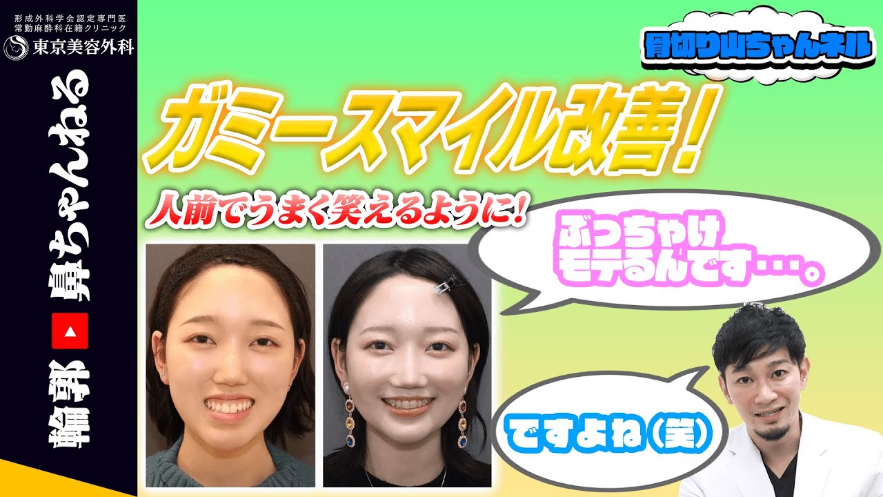 【骨切り山ちゃんネル】”ガミースマイル”を改善してモテ顔に…？💕