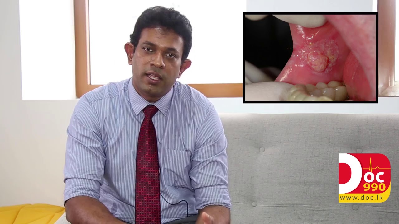 දන්ත හා මුඛ හනුක ශල්&zwj;ය වෛද්&zwj;යවරු | Oral And Maxillofacial Surgeon