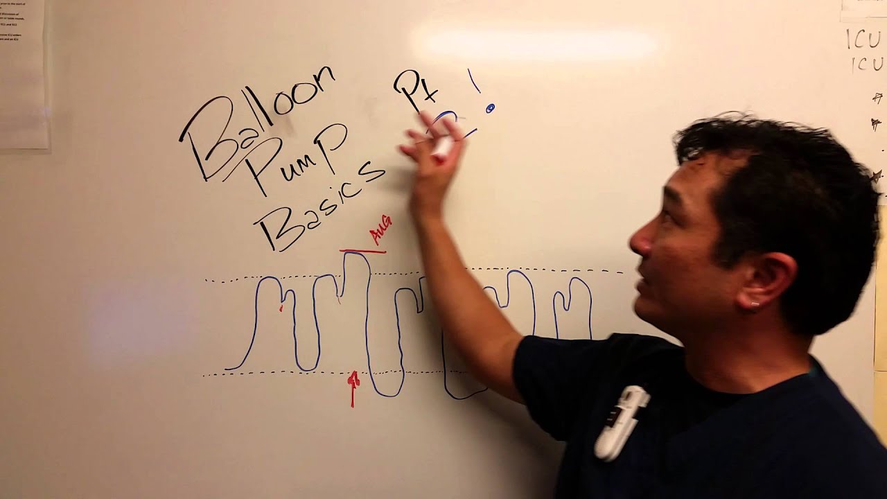 Balloon pump basics part 2