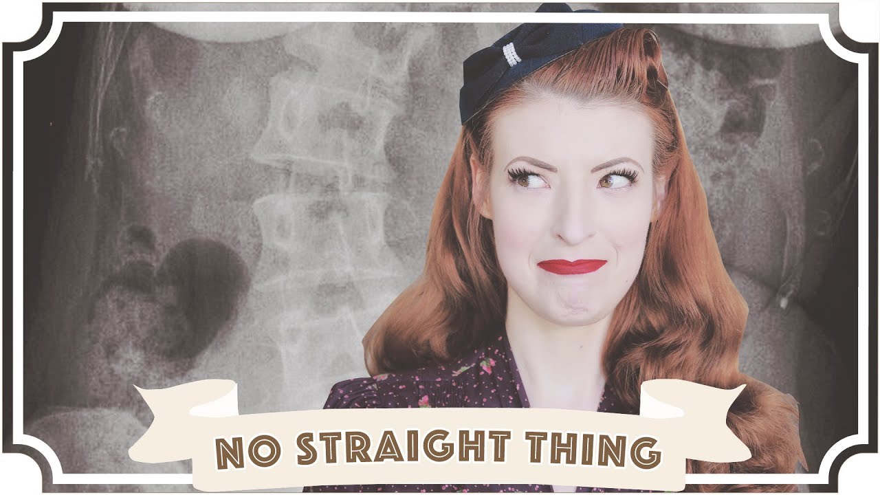 There's nothing straight about me // My scoliosis [CC]