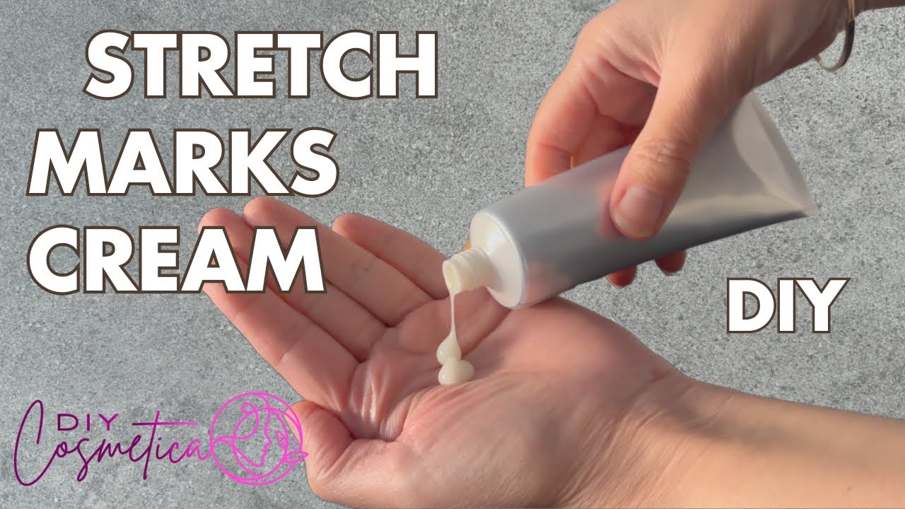 DIY Body Stretch Marks Cream