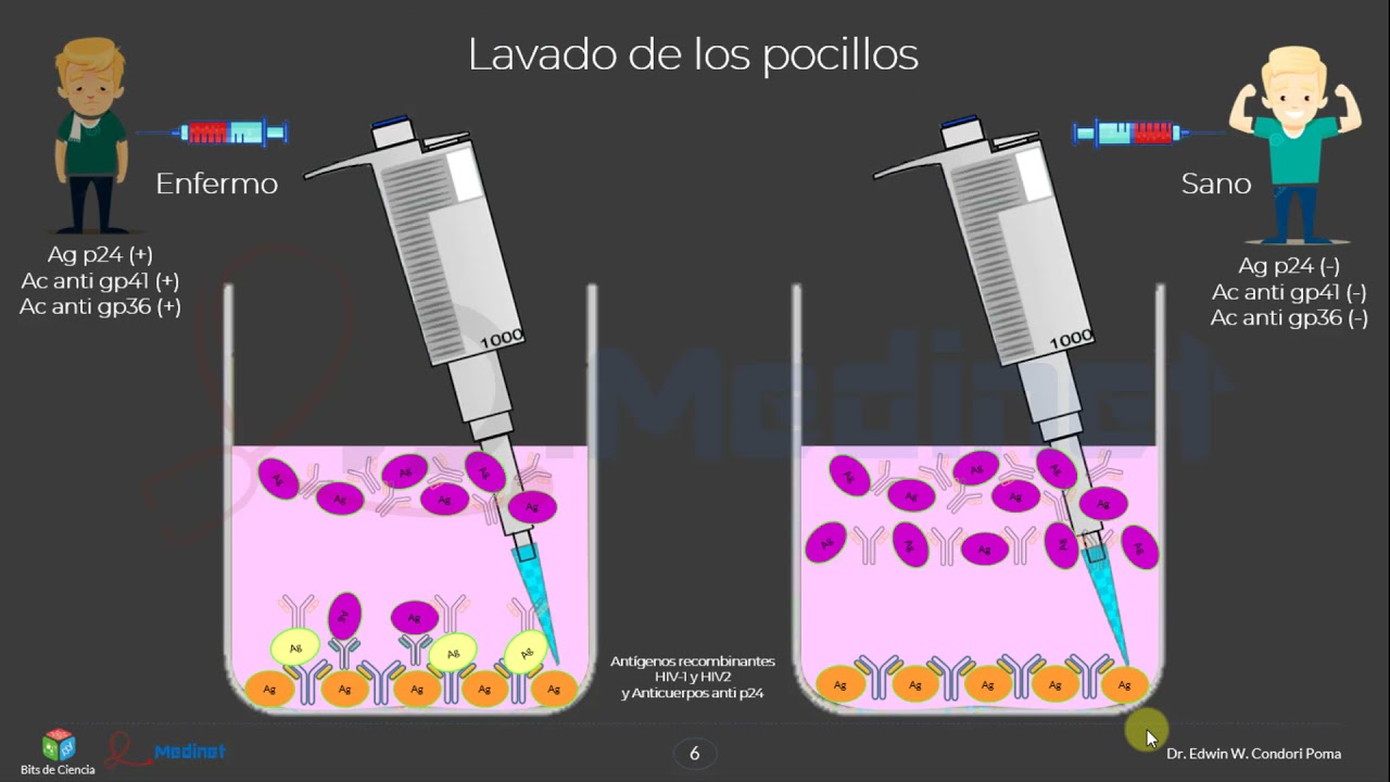 🔴 PRUEBA DE ELISA SÁNDWICH PARA DIAGNÓSTICO DE VIH 🔬EXPLICACIÓN PASO A PASO)