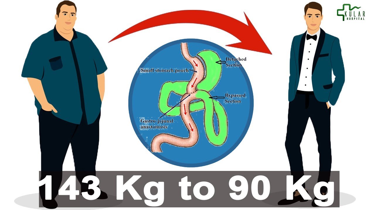 How I lost 53 Kgs without Dieting and Exercise| Safe way to lose weight| Dr. Kular