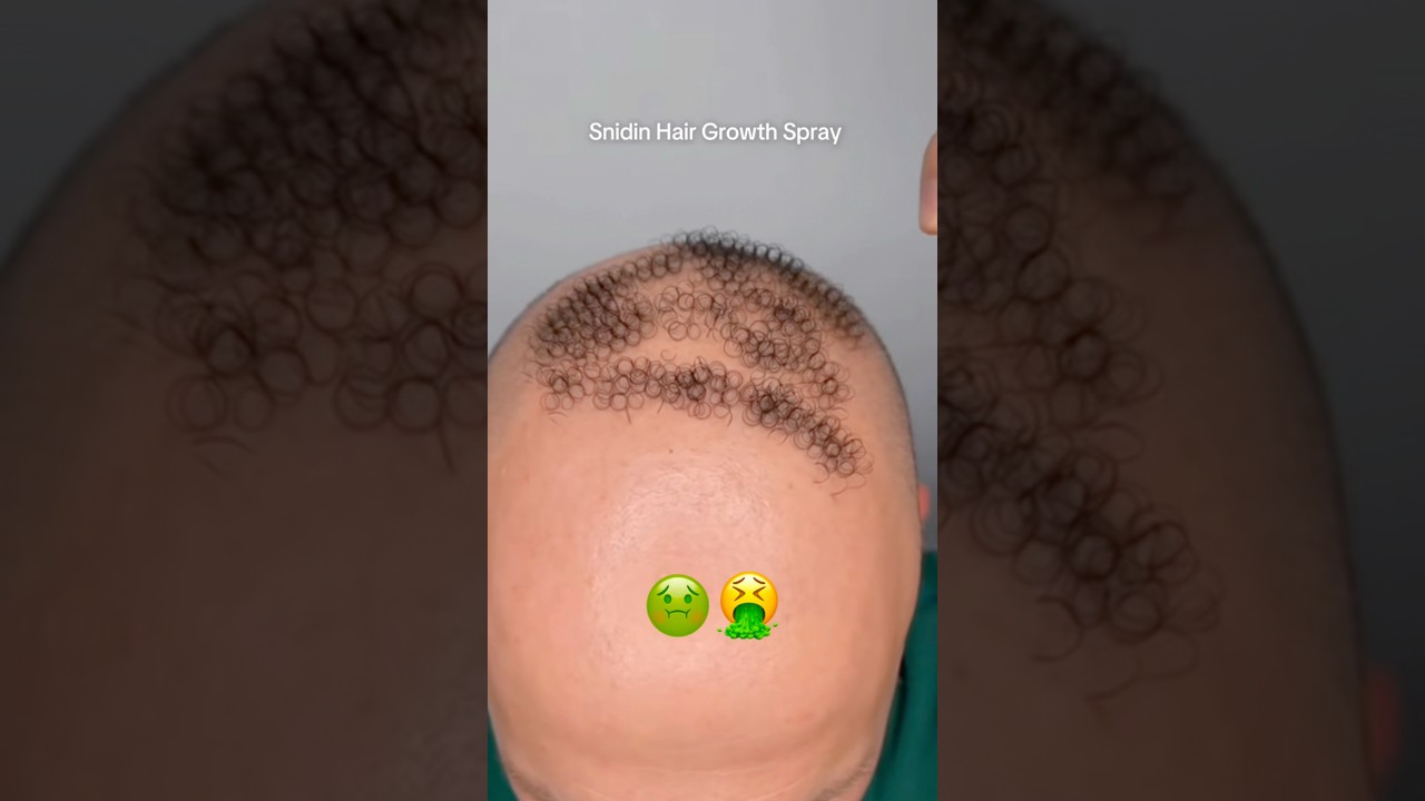 Hair regrowth spray uses PUEBES? 🤮🤮 #comedy #funny #alopecia #puebes