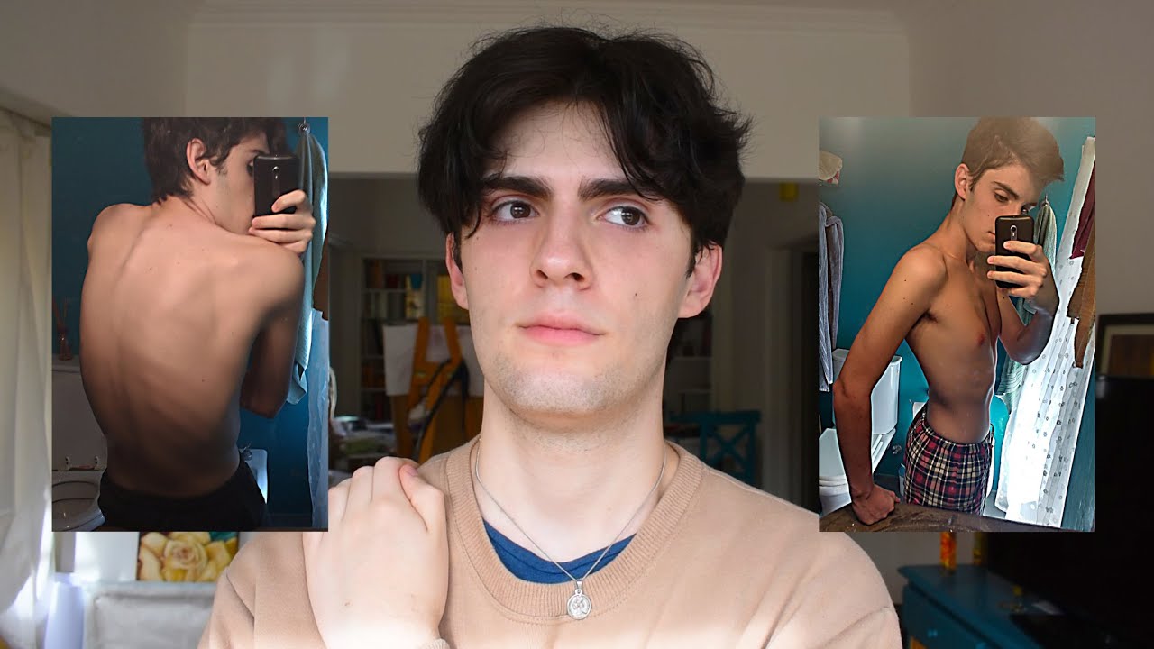 mi historia con la anorexia