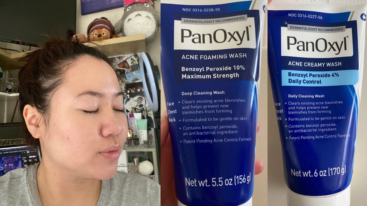 PanOxyl 10 vs 4% Acne Foaming Wash | Which is better for your skin?