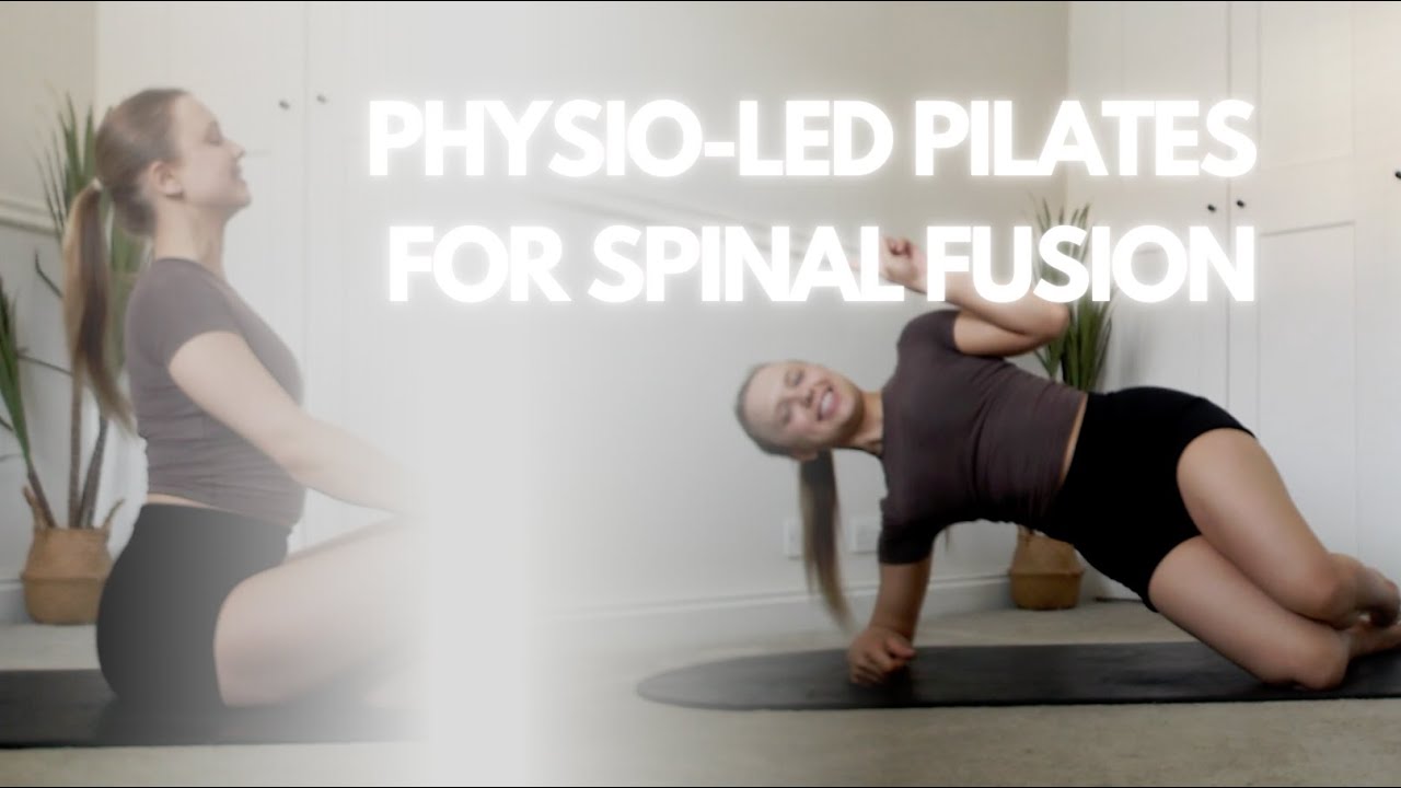 Physiotherapy led Pilates for Spinal Fusion