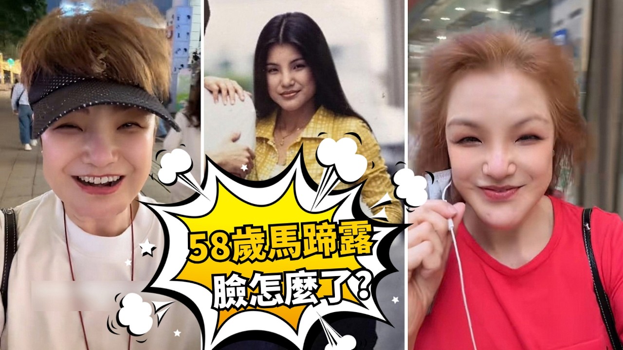 昔日「香港第一醜女」現狀曝光！58歲馬蹄露驚現僵硬闊面，網民質疑加工過度撞樣邵音音？