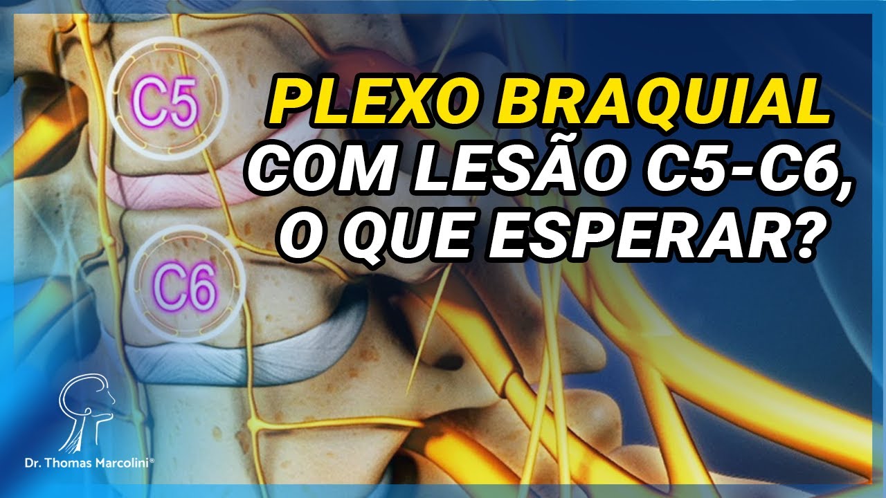 Lesão do Plexo Braquial C5-C6, O que esperar?