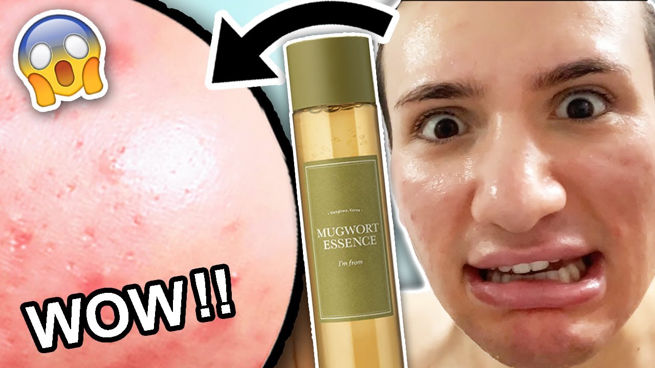 I tried the I'm from MUGWORT ESSENCE for ONE WEEK! 🌿 REVIEW || Amazing for ACNE?