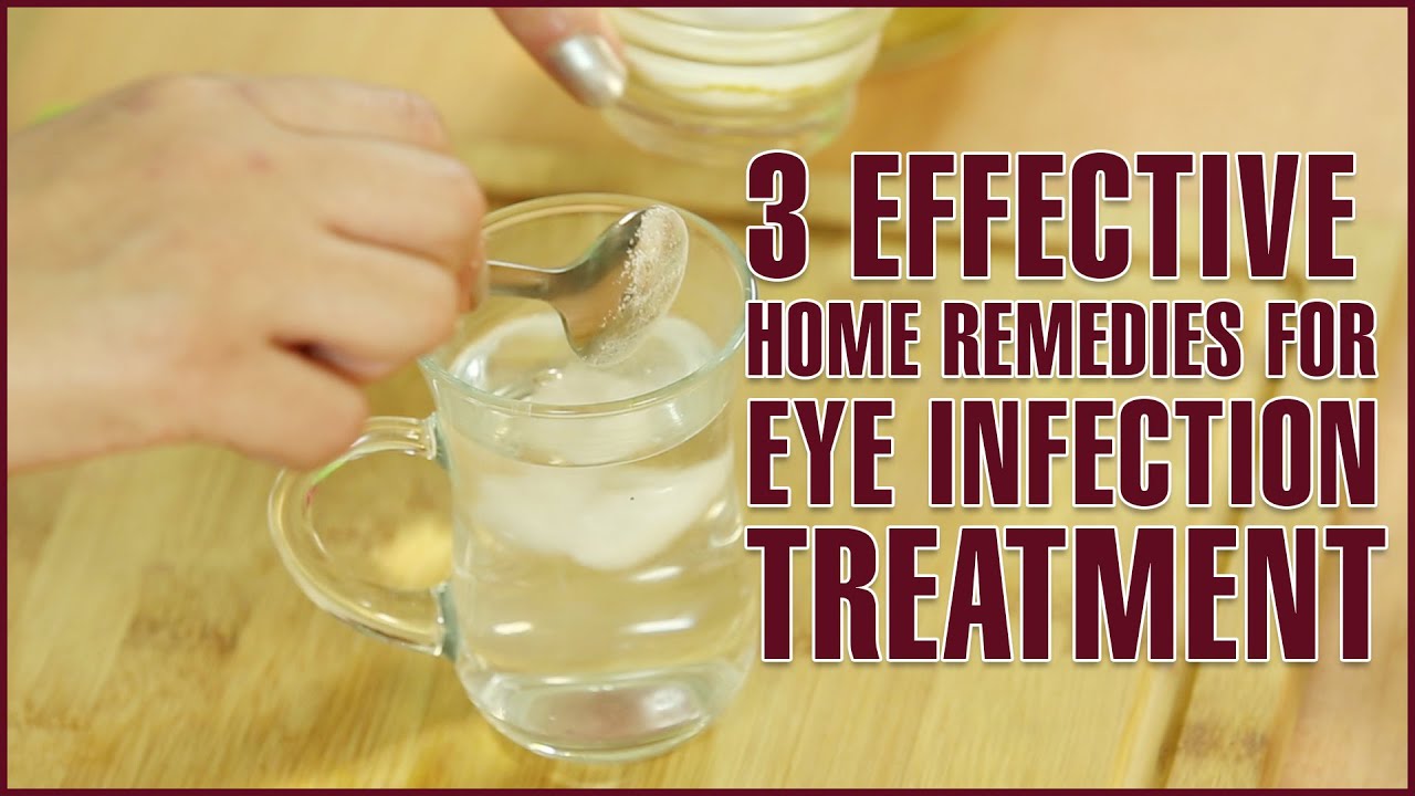 3 Easy & Effective Home Remedies For EYE INFECTION TREATMENT