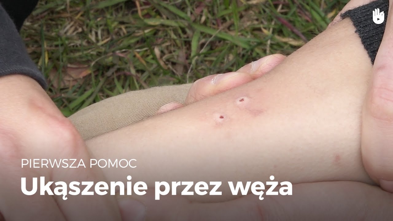 Naucz się gestów pierwszej pomocy -  Ukąszenie węża