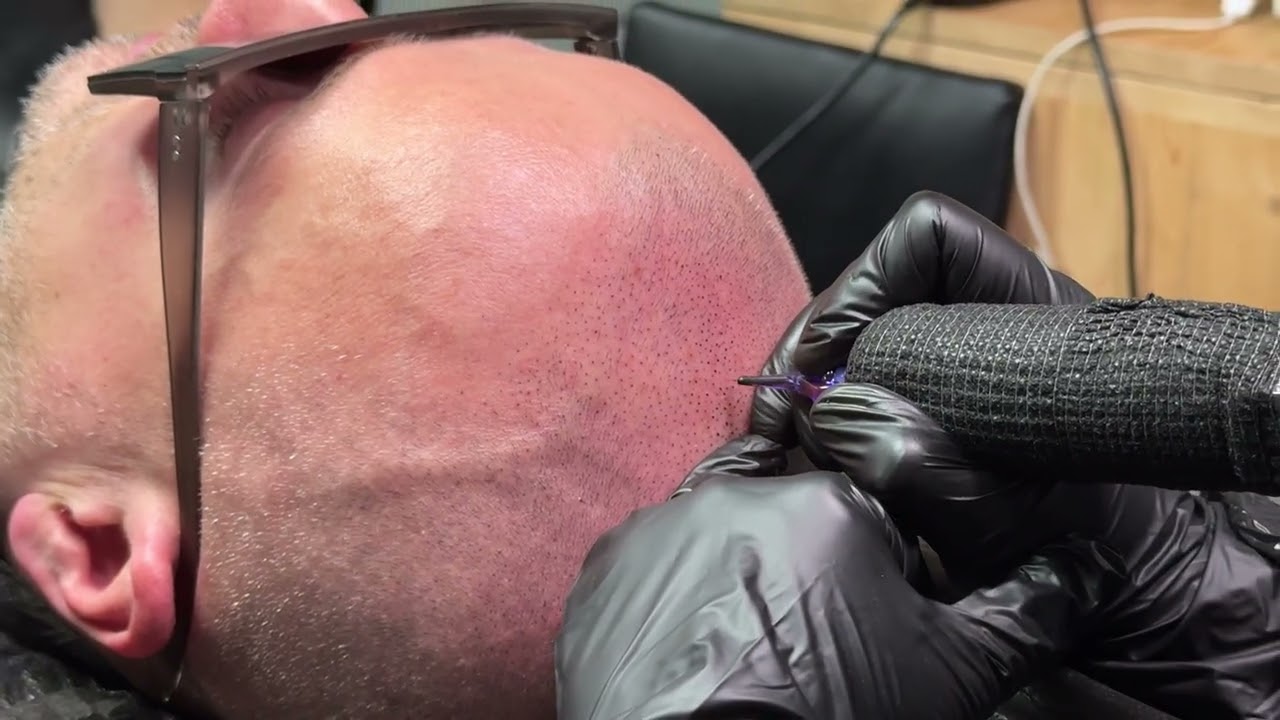 Трихопигментация волос в Санкт-Петербурге и Москве студия TRIHOSCALP #smp #tattoo #трихопигментация 