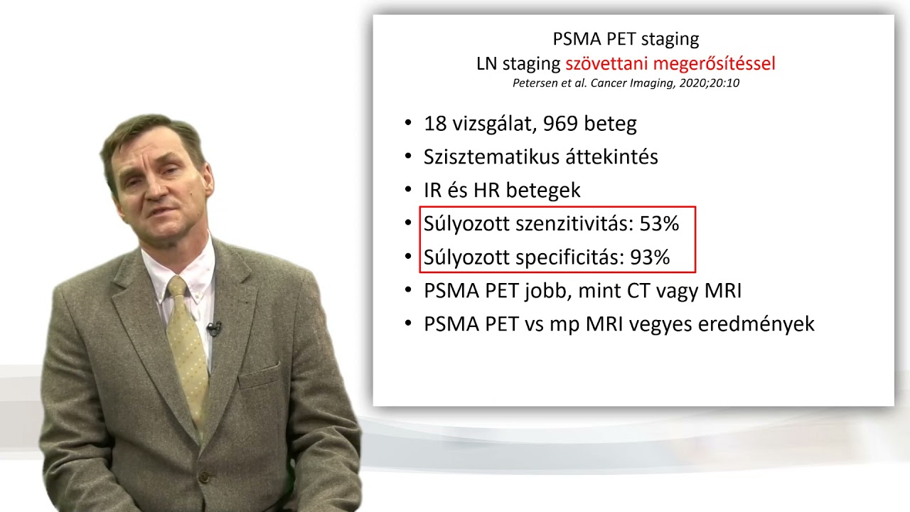 PSMA PET/CT szerepe a prosztatarákok ugárkezelésében