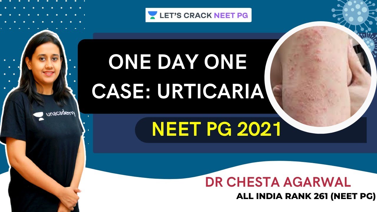 One Day One Case Series: Urticaria | Dermatology | NEET PG 2021 | Dr. Chesta Agarwal