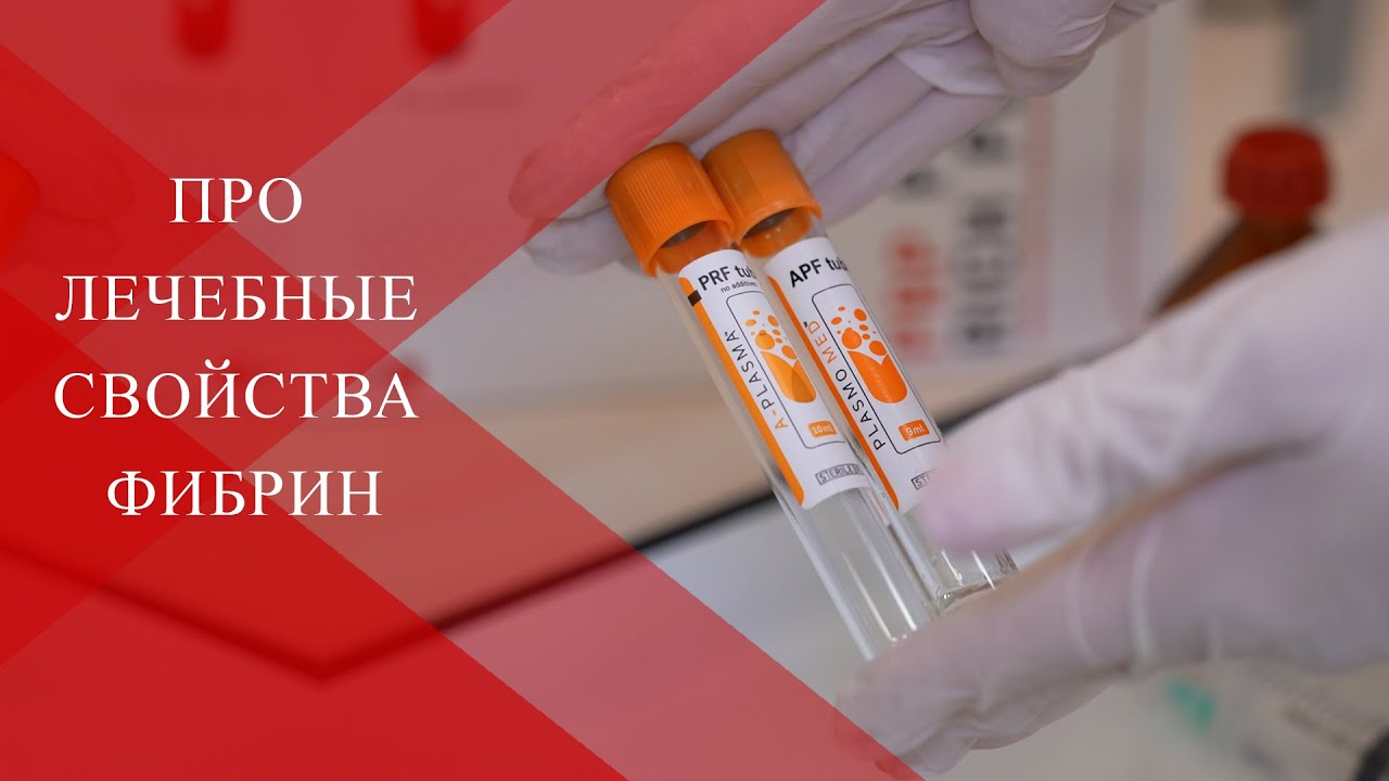 💉Про лечебные свойства ФИБРИН I-PRF| Практические рекомендации ДО И ПОСЛЕ
