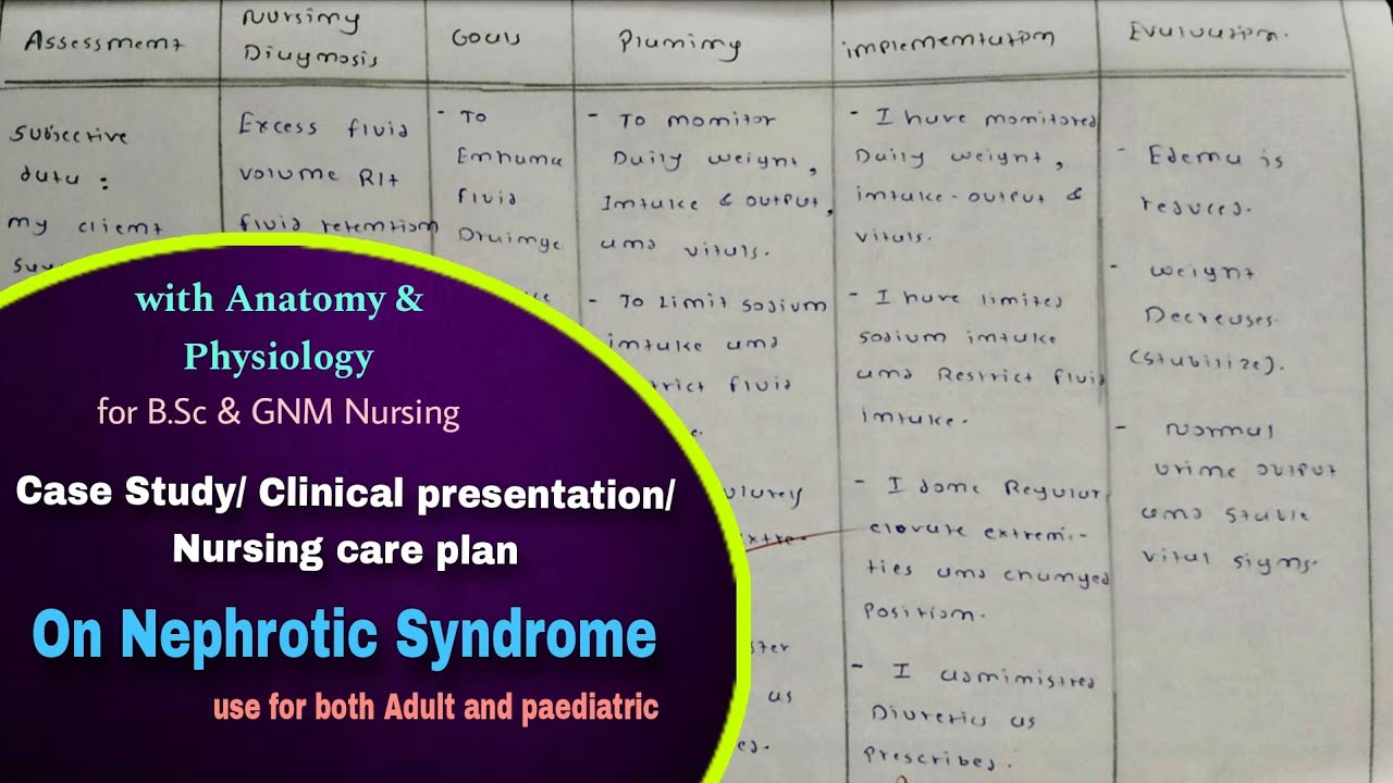 Case presentation on nephrotic syndrome | Nursing care plan | Nephrotic syndrome |